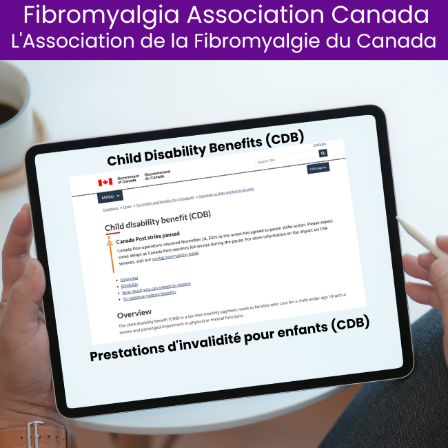 Child Disability Benefits (CDB)